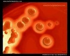 streptococcus zooepidemicus